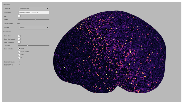 An Interactive Visualization for Neuronal Network Simulations of Plasticity Changes in the Human Brain